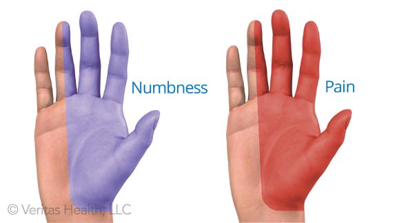 Followup on Carpal Tunnel