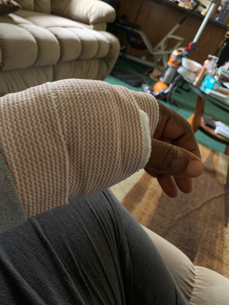 Yesterday’s Surgery