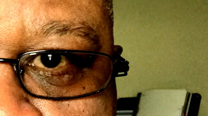 Some Benefits of Fasting