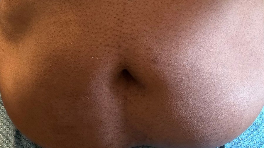 55 Days on Zero Carb Diet